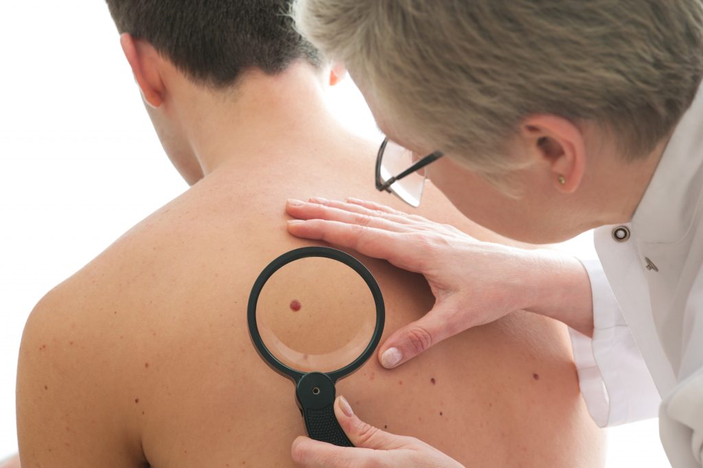 Dermatologist examining mole